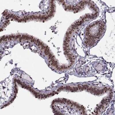 Immunohistochemistry-Paraffin: INT3 Antibody [NBP2-57633]