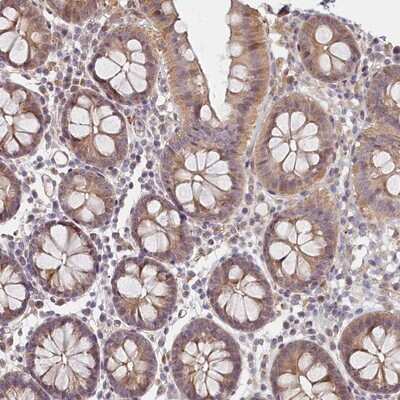 Immunohistochemistry-Paraffin: INT4 Antibody [NBP1-83102]
