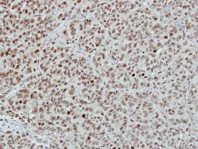 Immunohistochemistry-Paraffin: INT4 Antibody [NBP2-16971]