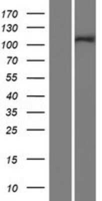 Western Blot: INT4 Overexpression Lysate [NBP2-05850]