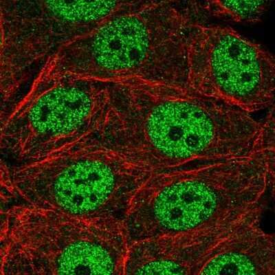 Immunocytochemistry/ Immunofluorescence: INTS1 Antibody [NBP2-55662]