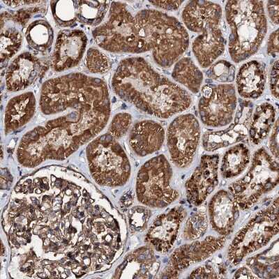 Immunohistochemistry-Paraffin: INTS10 Antibody [NBP1-91234]