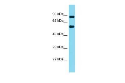 Western Blot: INTS10 Antibody [NBP2-85095]