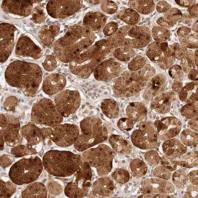 Immunohistochemistry-Paraffin: INTS11 Antibody [NBP1-85474]