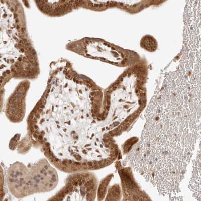 Immunohistochemistry-Paraffin: INTS11 Antibody [NBP1-85474]