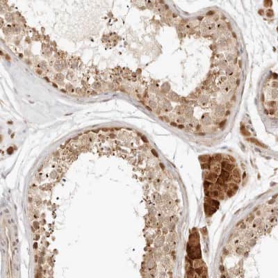 Immunohistochemistry-Paraffin: INTS11 Antibody [NBP1-85474]