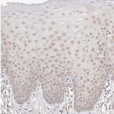 Immunohistochemistry-Paraffin: INTS11 Antibody [NBP1-85474]