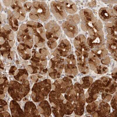 Immunohistochemistry-Paraffin: INTS11 Antibody [NBP1-85475]