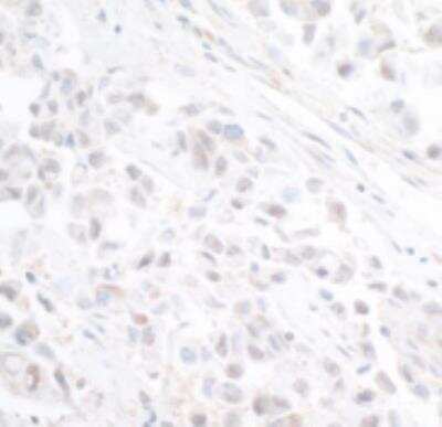 Immunohistochemistry-Paraffin: INTS11 Antibody [NB100-60638]