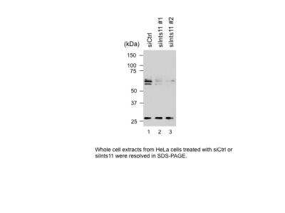 Western Blot: INTS11 Antibody [NB100-60638]
