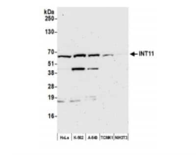 Western Blot: INTS11 Antibody [NB100-60638]