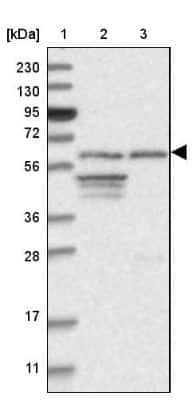 Western Blot: INTS11 Antibody [NBP1-85475]