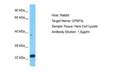 Western Blot: INTS11 Antibody [NBP2-87634]