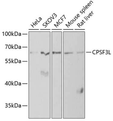 Western Blot: INTS11 AntibodyBSA Free [NBP3-03680]