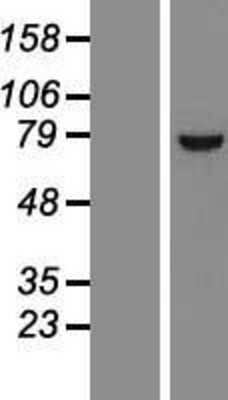 Western Blot: INTS11 Overexpression Lysate [NBL1-09447]