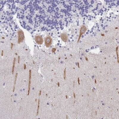 Immunohistochemistry-Paraffin: INTS5 Antibody [NBP2-47416]