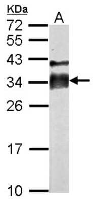 Western Blot: Intra Acrosomal Protein Antibody [NBP2-16979]