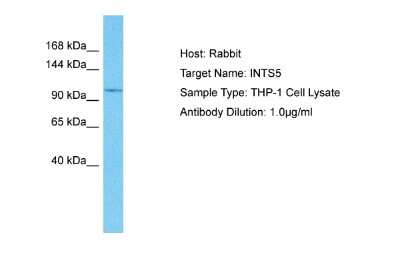 Western Blot: INTS5 Antibody [NBP2-85096]