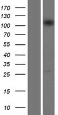 Western Blot: INTS5 Overexpression Lysate [NBP2-06195]