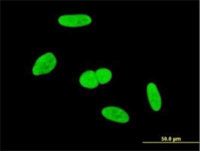 Immunocytochemistry/ Immunofluorescence: INTS6 Antibody (3D9) [H00026512-M02]