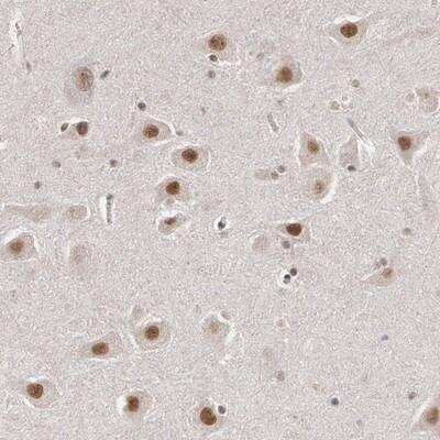 Immunohistochemistry: INTS6 Antibody [NBP1-88029]