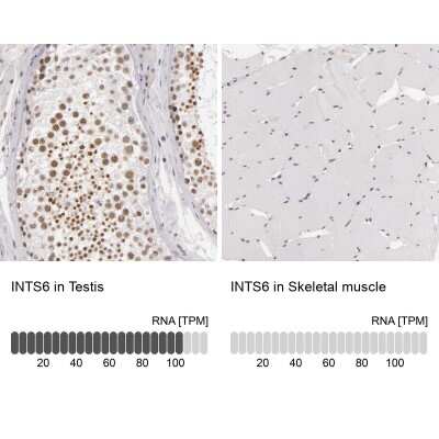 Immunohistochemistry-Paraffin: INTS6 Antibody [NBP1-85302]