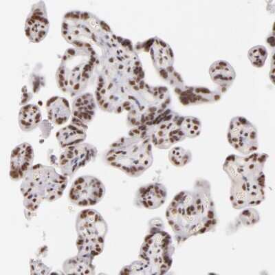 Immunohistochemistry-Paraffin: INTS6 Antibody [NBP1-85302]