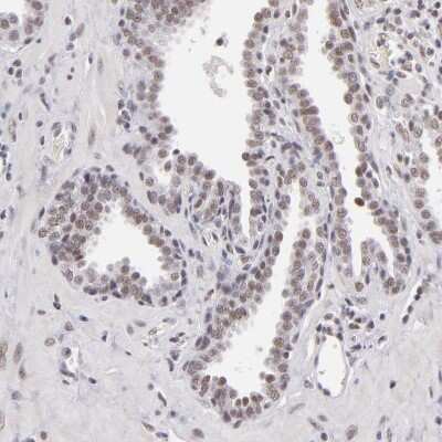 Immunohistochemistry-Paraffin: INTS6 Antibody [NBP1-85302]