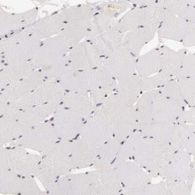 Immunohistochemistry-Paraffin: INTS6 Antibody [NBP1-85302]