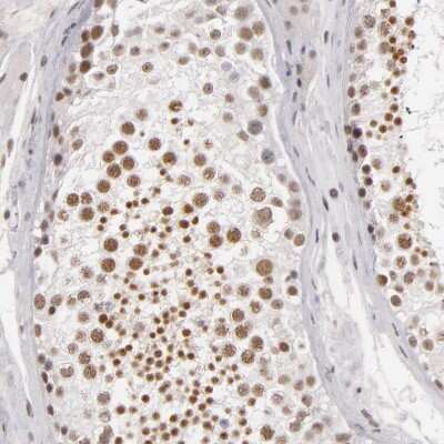 Immunohistochemistry-Paraffin: INTS6 Antibody [NBP1-85302]