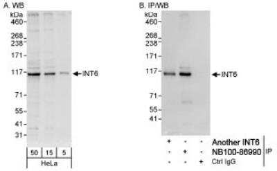 Western Blot: INTS6 Antibody [NB100-86990]