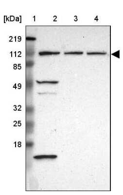 Western Blot: INTS6 Antibody [NBP1-85302]