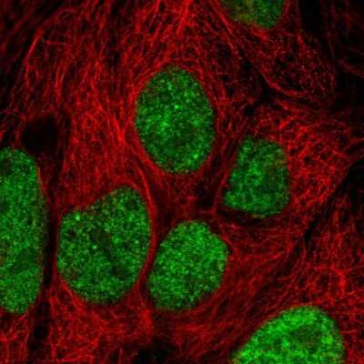 Immunocytochemistry/ Immunofluorescence: INTS8 Antibody [NBP2-33826]