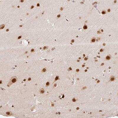 Immunohistochemistry-Paraffin: INTS8 Antibody [NBP2-33826]