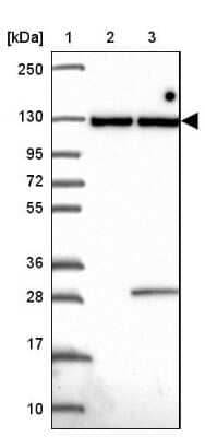 Western Blot: INTS8 Antibody [NBP2-33826]