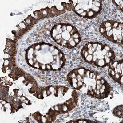 Immunohistochemistry-Paraffin: INTU Antibody [NBP2-48663]