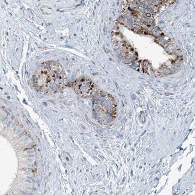 Immunohistochemistry-Paraffin: INTU Antibody [NBP2-48663]