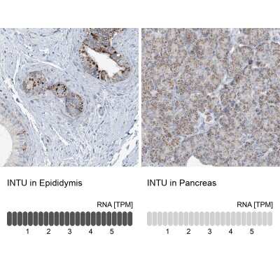 Immunohistochemistry-Paraffin: INTU Antibody [NBP2-48663]