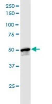 Western Blot: INTU Antibody [H00027152-B01P]