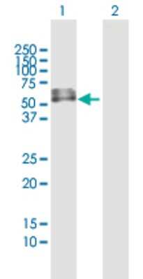 Western Blot: INTU Antibody [H00027152-B01P]