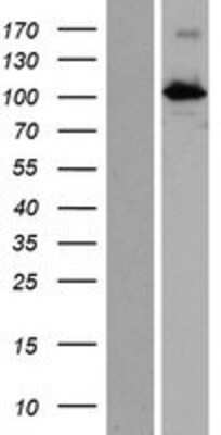 Western Blot: INTU Overexpression Lysate [NBP2-07130]