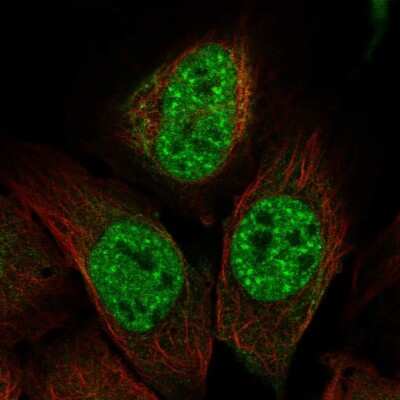 Immunocytochemistry/ Immunofluorescence: IP3KC Antibody [NBP2-49068]