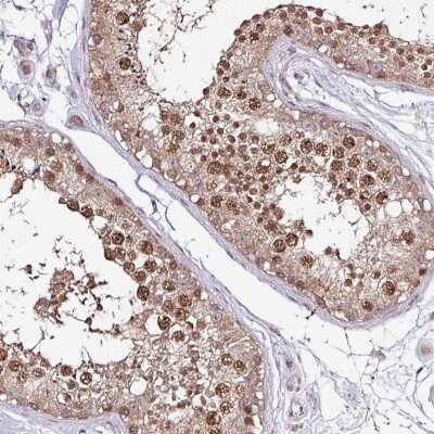 Immunohistochemistry: IP3KC Antibody [NBP2-49068]