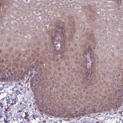 Immunohistochemistry-Paraffin: IP3KC Antibody [NBP2-48975]