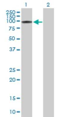 Western Blot: IP3KC Antibody [H00080271-B01P]