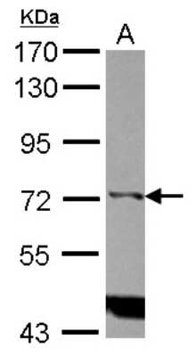 Western Blot: IP3KC Antibody [NBP2-16982]