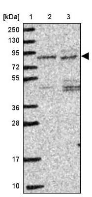 Western Blot: IP3KC Antibody [NBP2-49068]