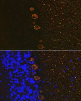 Immunohistochemistry: IP3R1 Antibody (4Z1B6) [NBP3-16414]