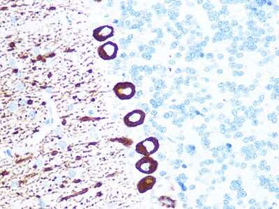 Immunohistochemistry-Paraffin: IP3R1 Antibody (4Z1B6) [NBP3-16414]