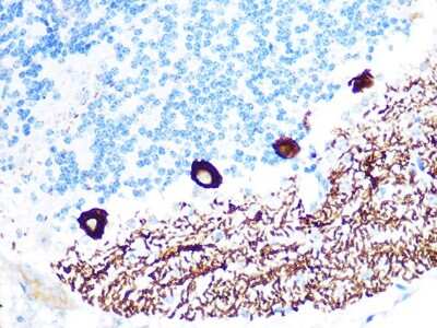 Immunohistochemistry-Paraffin: IP3R1 Antibody (4Z1B6) [NBP3-16414]